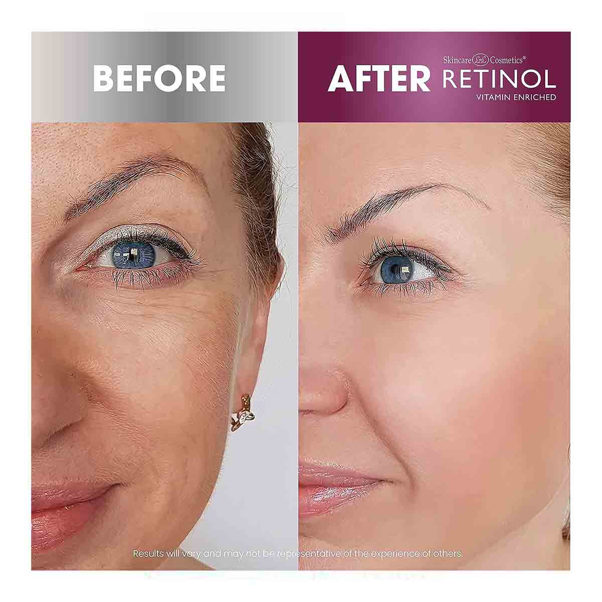 سرم ضد چروک قوی رتینول RETINOL مدل ANTI-WRINKLE FACIAL SERUM حجم 30 میل